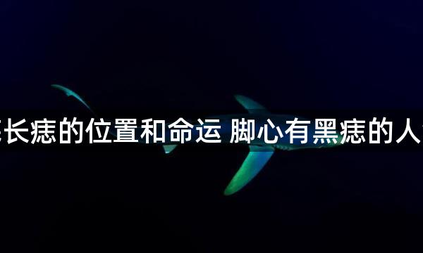 脚底长痣的位置和命运 脚心有黑痣的人命运